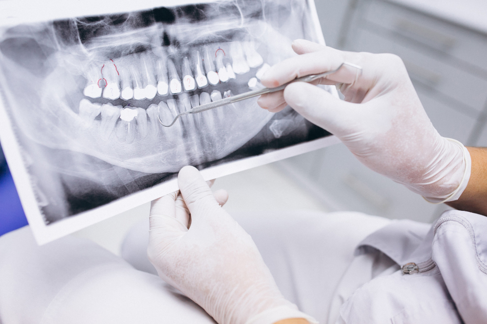 Dental X-rays